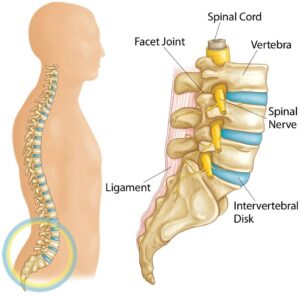 Muscular Back Pain vs Disc Back Pain - Spinal Backrack