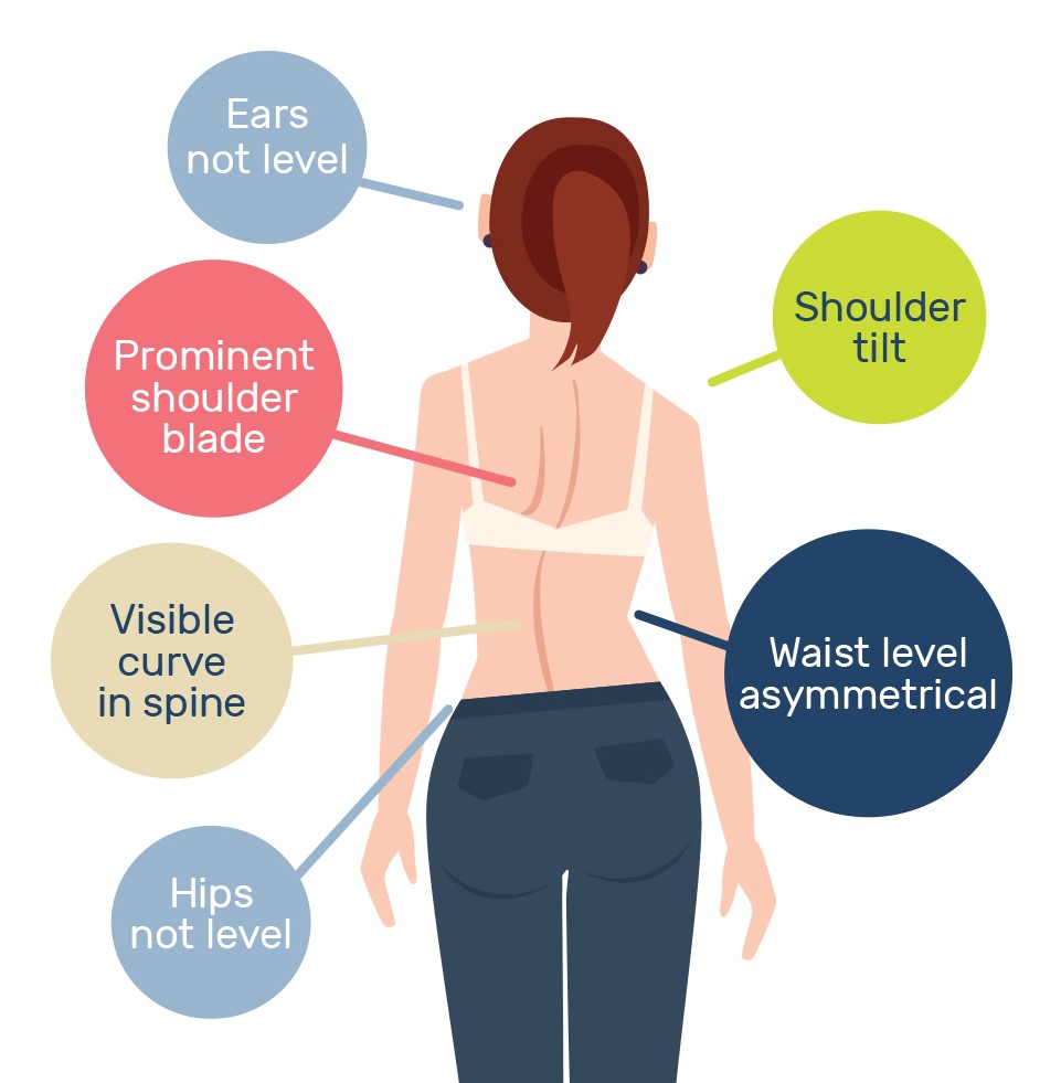 Scoliosis What You Need To Know Peak Health And Performance
